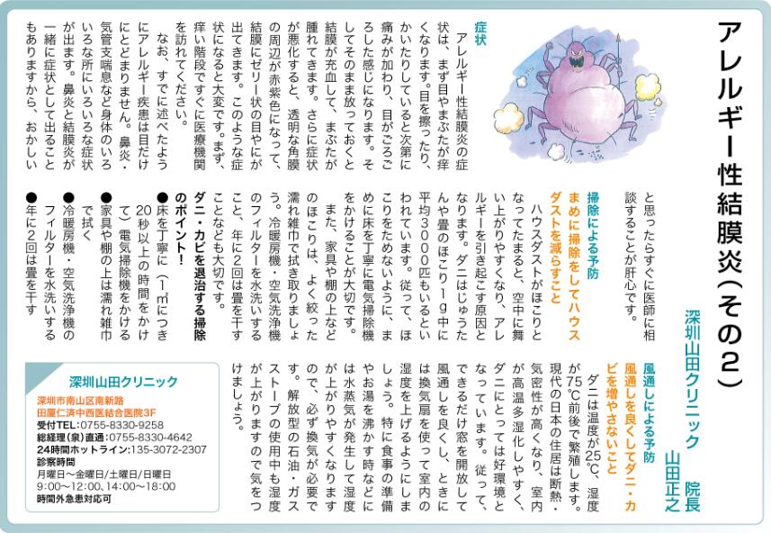 アレルギー性結膜炎（その2）